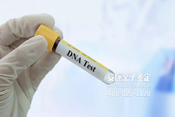 常州做DNA亲子鉴定多久能出结果？是否能够加急？ 